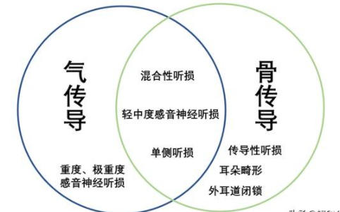 骨传导助听器的缺点有哪些